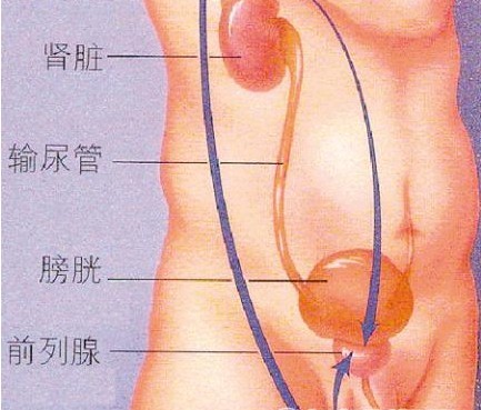 一般得了前列腺增生会出现哪些症状