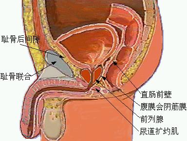 男性前列腺增生该怎么办？