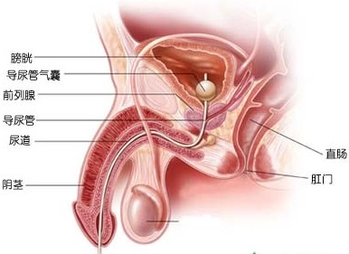治疗前列腺炎