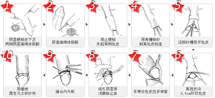 铜仁割包皮全国前三的医院