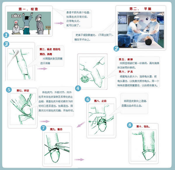 湖南治疗包茎医院