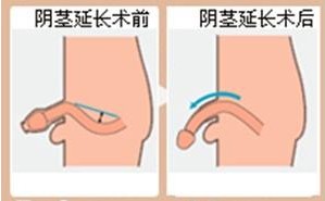 手淫会不会导致阴茎短小