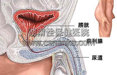 湖南性保健治疗尿道炎