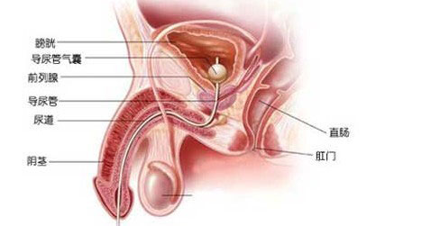 男性急性尿道炎怎么护理全国前三