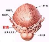 慢性精囊炎会引发不育