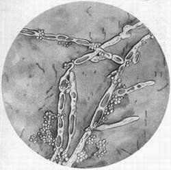 湖南性保健治疗生殖器疱疹需要多少钱