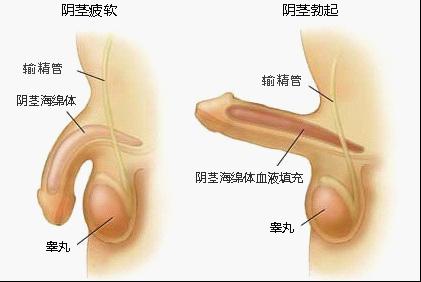 频繁的性生活会造成阳痿吗