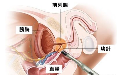 铜仁做早泄检查需要多少钱？国家公立医院收费更公道